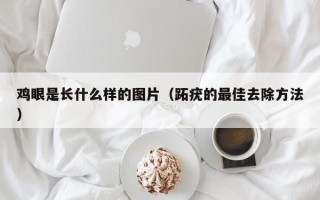 鸡眼是长什么样的图片（跖疣的最佳去除方法）