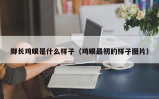 脚长鸡眼是什么样子（鸡眼最初的样子图片）